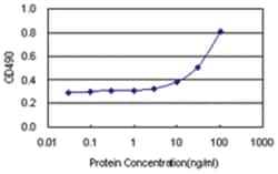 QPRT, Human, Matched Antibody Pair (AP21), Abnova&trade;