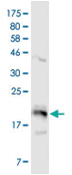 anti-TNFRSF13B, Clone: 1G11, Abnova 100&mu;g, Unlabeled:Antibodies, Monoclonal