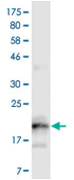 anti-TNFRSF13B, Clone: 4A9, Abnova 100&mu;g, Unlabeled:Antibodies, Monoclonal