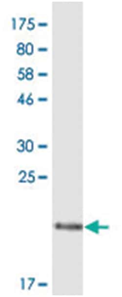 anti-TNFRSF13B (M11), Mouse anti-Human, Clone: 1C9, Abnova 100 &mu;g | Buy Online | Abnova | Fisher Scientific
