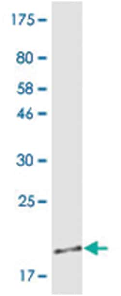 anti-TNFRSF13B, Clone: 1G1, Abnova 100 &mu;g | Buy Online | Abnova | Fisher Scientific