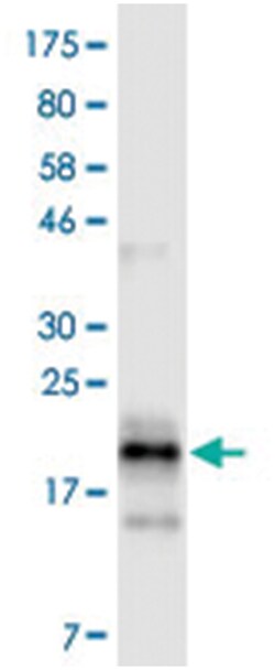 anti-TNFRSF13B, Clone: 4G1, Abnova 100 &mu;g | Buy Online | Abnova Corporation | Fisher Scientific
