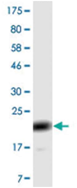 Abnova Corporation anti-TNFRSF13B, Clone: 1E1., Abnova™