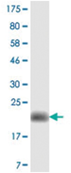 anti-TNFRSF13B, Clone: 1D5, Abnova 100 &mu;g | Buy Online | Abnova Corporation | Fisher Scientific