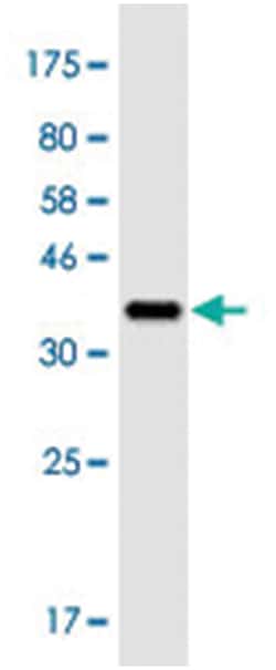 CABIN1, Mouse, Clone: 2F5, Abnova 200 &mu;L | Buy Online | Abnova Corporation | Fisher Scientific