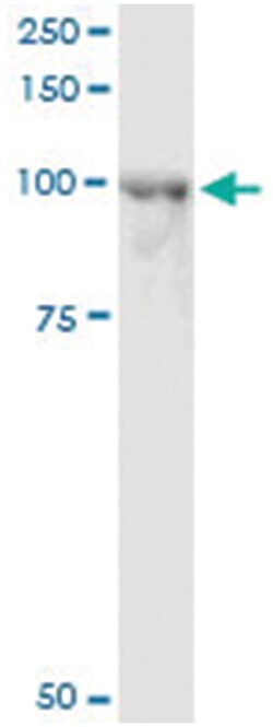 anti-ACAP2, Human, IP-WB Antibody Pair, Abnova™