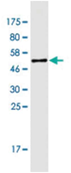 CLCF1, Mouse, Clone: 7E10, Abnova 200&mu;L; Unlabeled:Antibodies, Monoclonal