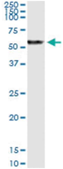 anti-PRAME, Human, IP-WB Antibody Pair, Abnova 1 Set:Antibodies, Monoclonal/Polyclonal
