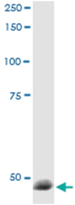anti-RBM9, Human, IP-WB Antibody Pair, Abnova&trade;