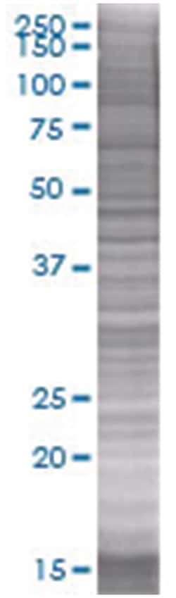 DNPEP 293T Cell Overexpression Lysate (Denatured), Abnova