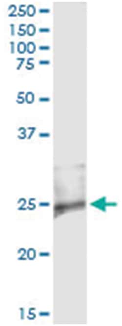 anti-RASD2, Human, IP-WB Antibody Pair, Abnova 1 Set:Antibodies, Monoclonal/Polyclonal