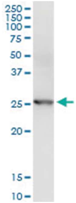 anti-CCRK, Human, IP-WB Antibody Pair, Abnova 1 Set | Buy Online | Abnova Corporation | Fisher Scientific