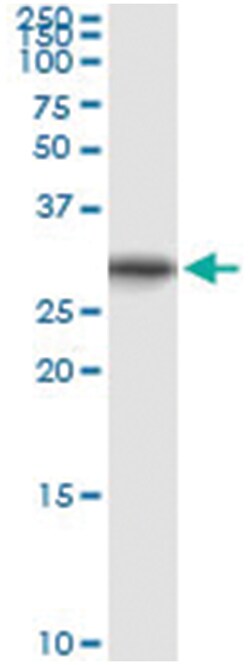 ORC6L, Human, IP-WB Antibody Pair (PW1), Abnova&trade;
