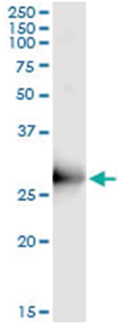 ORC6L, Human, IP-WB Antibody Pair (PW2), Abnova&trade;