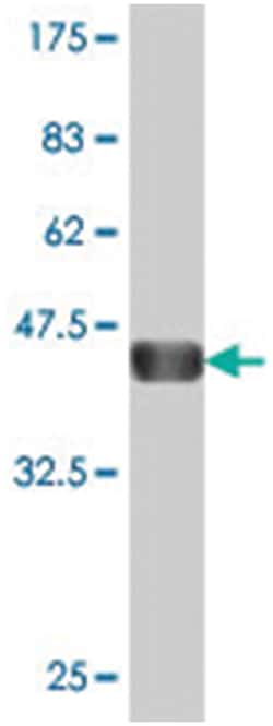 ZMYND8, Mouse, Polyclonal Antibody, Abnova 50&mu;L; Unlabeled:Antibodies,