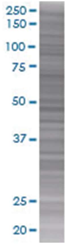 LDOC1 293T Cell Overexpression Lysate (Denatured), Abnova 100 &mu;L | Buy Online | Abnova | Fisher Scientific
