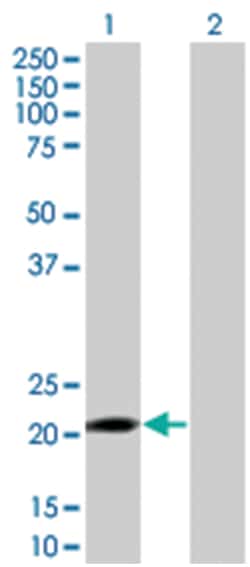 LDOC1 293T Cell Overexpression Lysate (Denatured), Abnova 100 &mu;L | Buy Online | Abnova | Fisher Scientific