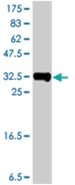 SSBP3, Mouse, Polyclonal Antibody, Abnova 50&mu;L; Unlabeled:Antibodies,