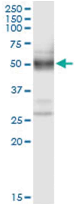 anti-PLA2G15, Human, IP-WB Antibody Pair, Abnova&trade;