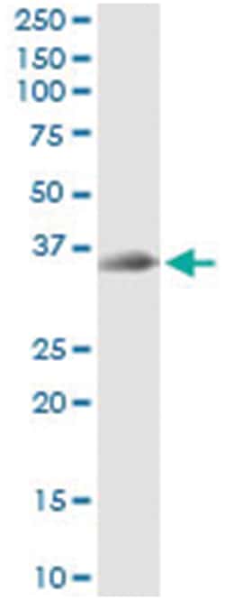 STX12, Human, IP-WB Antibody Pair (PW2), Abnova&trade;