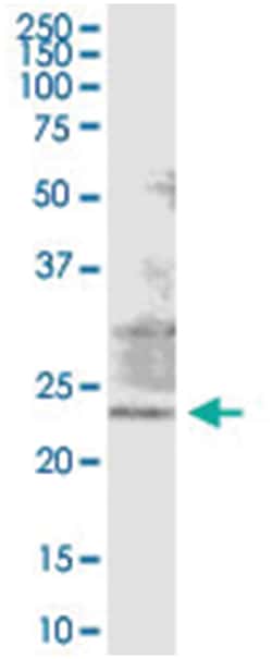 anti-RAB38, Human, IP-WB Antibody Pair, Abnova&trade;