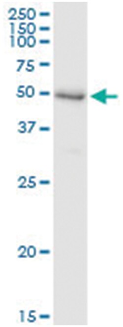 anti-SHPK, Human, IP-WB Antibody Pair, Abnova 1 Set:Antibodies, Monoclonal/Polyclonal