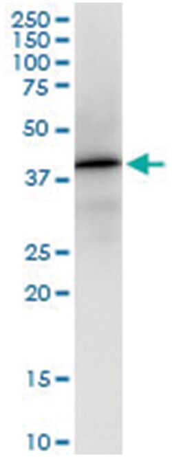 anti-APOL2, Human, IP-WB Antibody Pair, Abnova™
