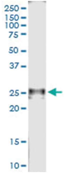 anti-RAD54B, Human, IP-WB Antibody Pair, Abnova&trade;