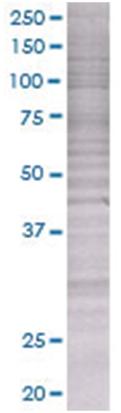 RAD54B 293T Cell Overexpression Lysate (Denatured), Abnova