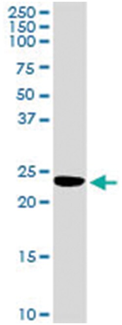 anti-PRDX5, Human, IP-WB Antibody Pair, Abnova™