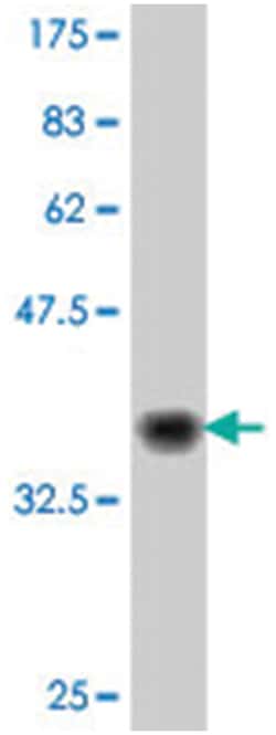 HECTD1, Mouse, Polyclonal Antibody, Abnova 50&mu;L; Unlabeled:Antibodies,