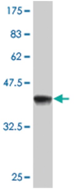 ASF1A, Mouse, Clone: 2G10, Abnova 200&mu;L; Unlabeled:Antibodies, Monoclonal
