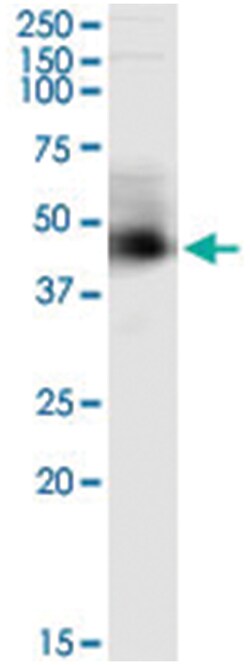 anti-ARMC8, Human, IP-WB Antibody Pair, Abnova&trade;