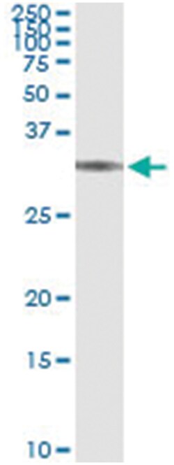 anti-BRMS1, Human, IP-WB Antibody Pair, Abnova&trade;