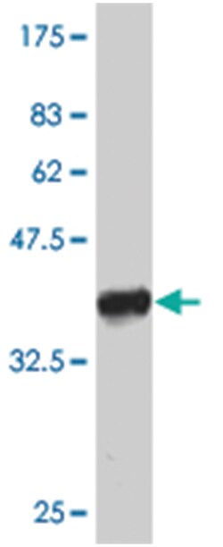 DFNB31, Mouse, Polyclonal Antibody, Abnova 50&mu;L; Unlabeled:Antibodies,