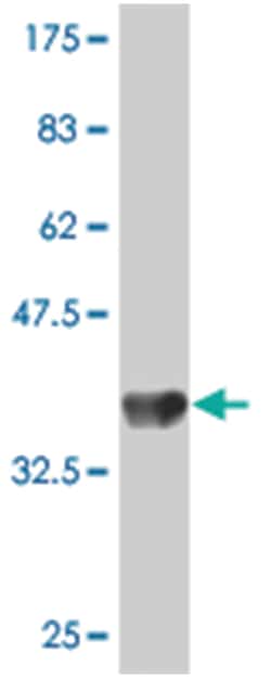 TRIM58, Mouse, Polyclonal Antibody, Abnova 50&mu;L; Unlabeled:Antibodies,