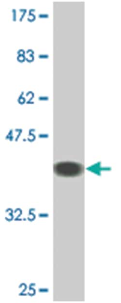 ring finger protein 19A, Mouse, Clone: 4E4, Abnova&trade;