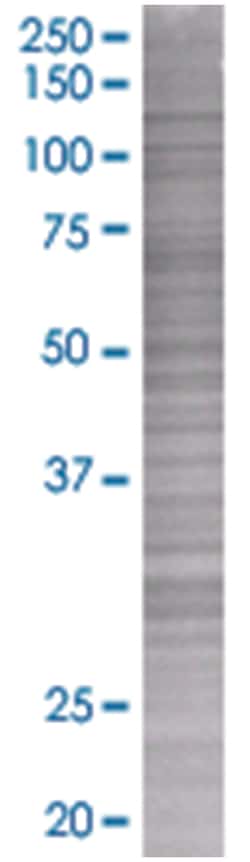 SH2B 293T Cell Overexpression Lysate (Denatured), Abnova 100 &mu;L | Buy Online | Abnova | Fisher Scientific