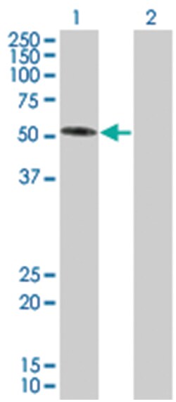 SH2B 293T Cell Overexpression Lysate (Denatured), Abnova 100 &mu;L | Buy Online | Abnova | Fisher Scientific