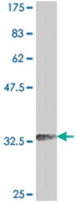 RNF167, Mouse, Polyclonal Antibody, Abnova 50&mu;L; Unlabeled:Antibodies,