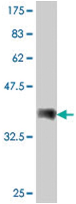 PCDHGA12, Mouse, Polyclonal Antibody, Abnova 50&mu;L; Unlabeled:Antibodies,