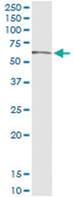 anti-GLCE, Human, IP-WB Antibody Pair, Abnova&trade;
