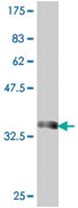 zinc finger protein 500, Mouse, Polyclonal Antibody, Abnova 50 &mu;L | Buy Online | Abnova Corporation | Fisher Scientific