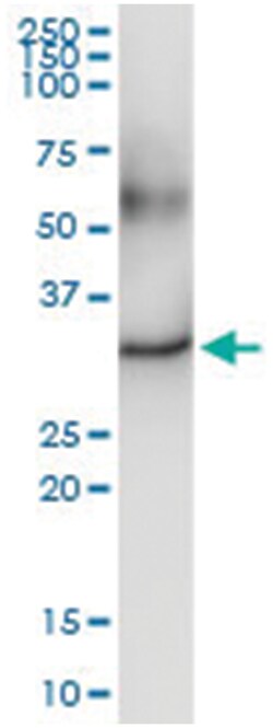 anti-DECR2, Human, IP-WB Antibody Pair, Abnova&trade;