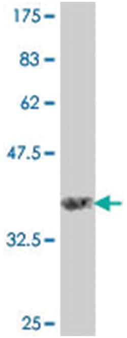 HERC4, Mouse, Polyclonal Antibody, Abnova 50 &mu;L | Buy Online | Abnova Corporation | Fisher Scientific