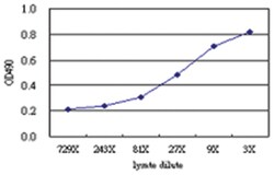 anti-KIF26A Matched Antibody Pair, Abnova&trade;