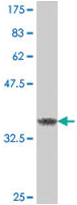 FBXL3, Mouse, Polyclonal Antibody, Abnova 50&mu;L; Unlabeled:Antibodies,