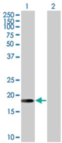 ARL5A 293T Cell Overexpression Lysate (Denatured), Abnova