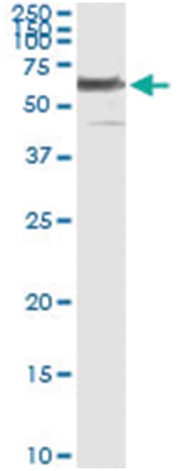 PHGDH, Human, IP-WB Antibody Pair (PW1), Abnova™