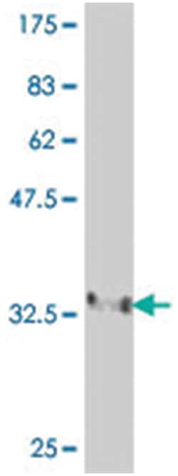 FBXL4, Mouse, Polyclonal Antibody, Abnova 50&mu;L; Unlabeled:Antibodies,